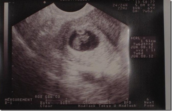 IMG_0666 - Copy - Copy